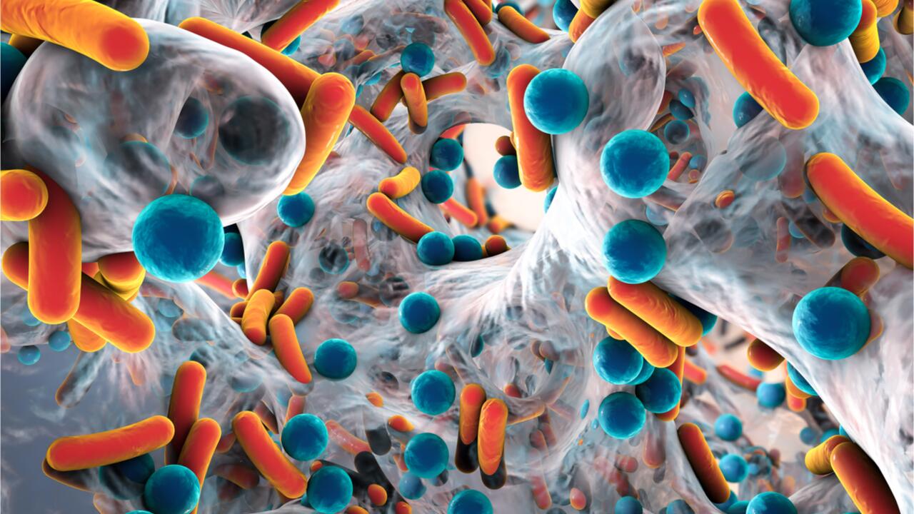 1,2 Millionen Todesfälle infolge von Antibiotika-Resistenzen 2019 