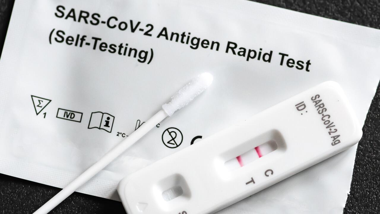 Aktuell eine häufige Frage: Was soll ich tun, wenn der Corona-Test positiv ist?