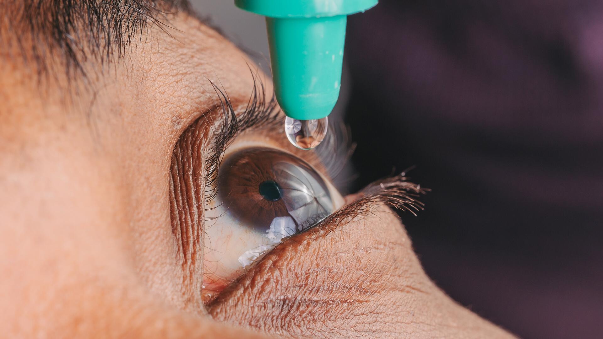 Mittel gegen trockene Augen im Test: Wir haben 21 Produkte getestet.