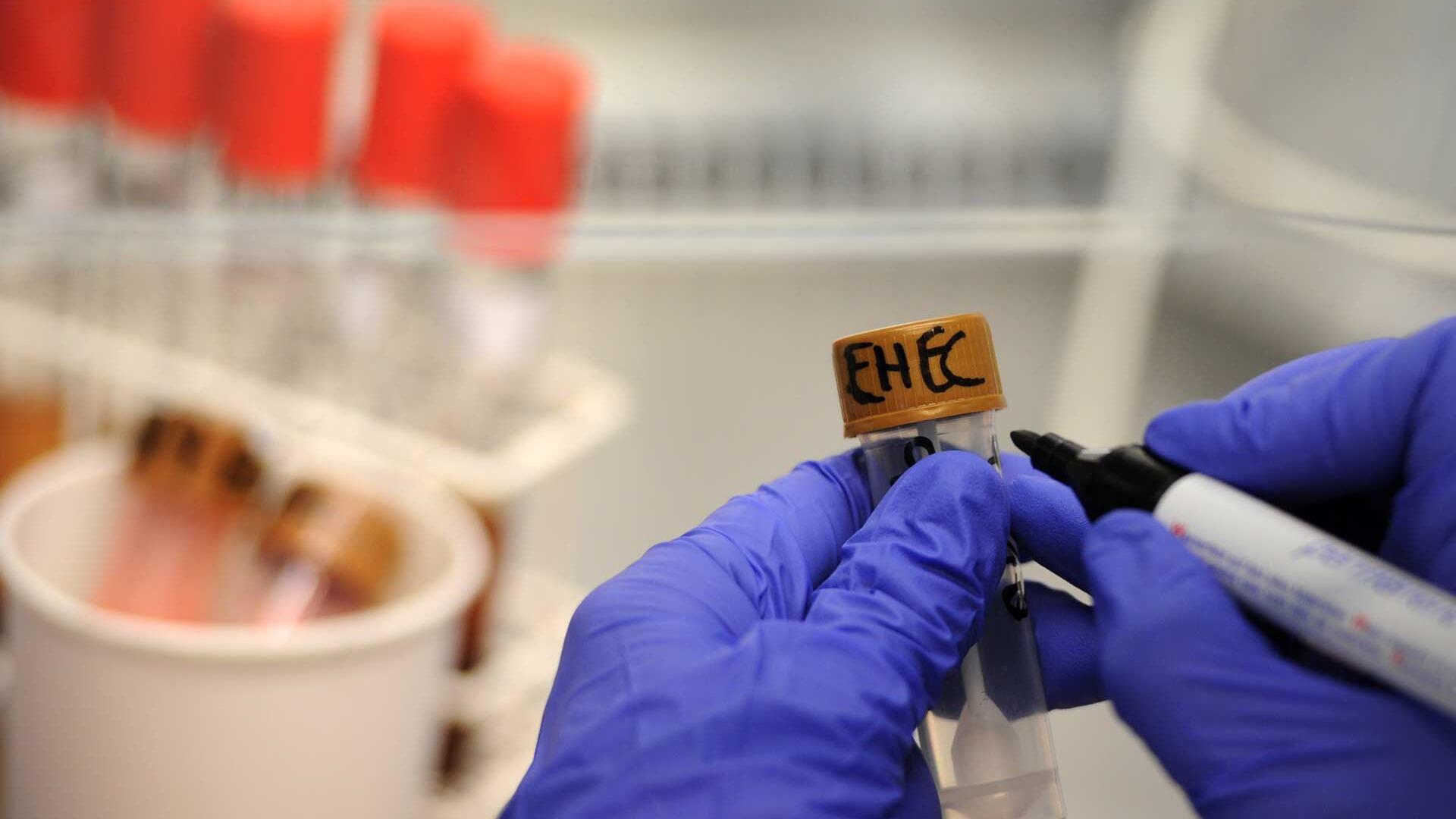 Person schreibt "EHEC" auf Probe