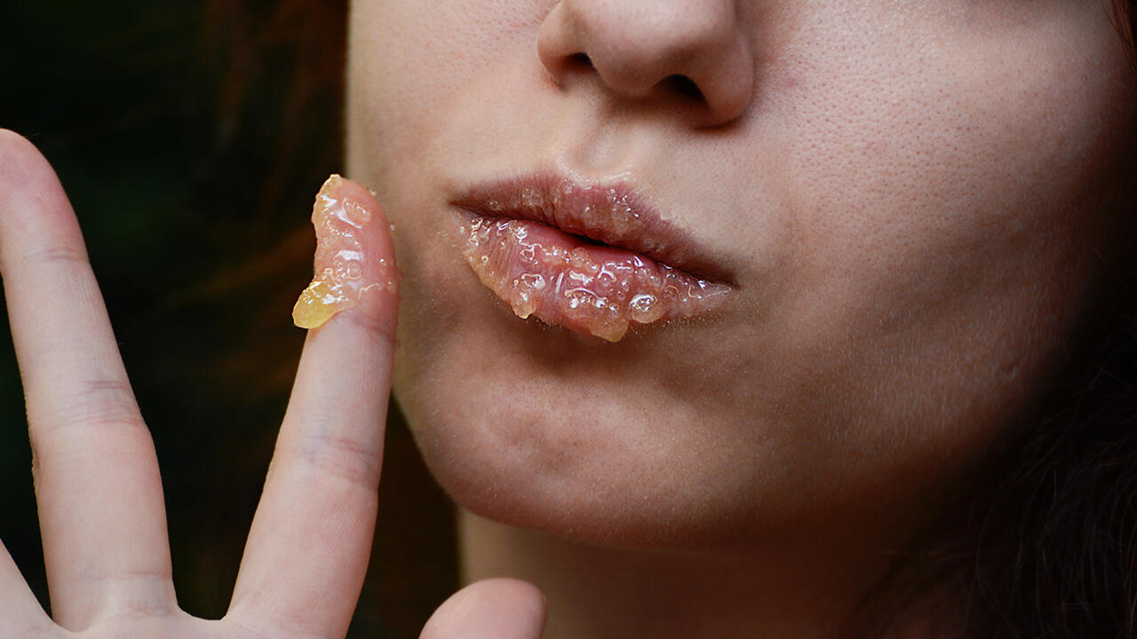Wer spröde Lippen hat, kann sich einfach etwas Honig auf die Lippen schmieren. Wer spröde Lippen hat, kann sich einfach etwas Honig auf die Lippen schmieren.