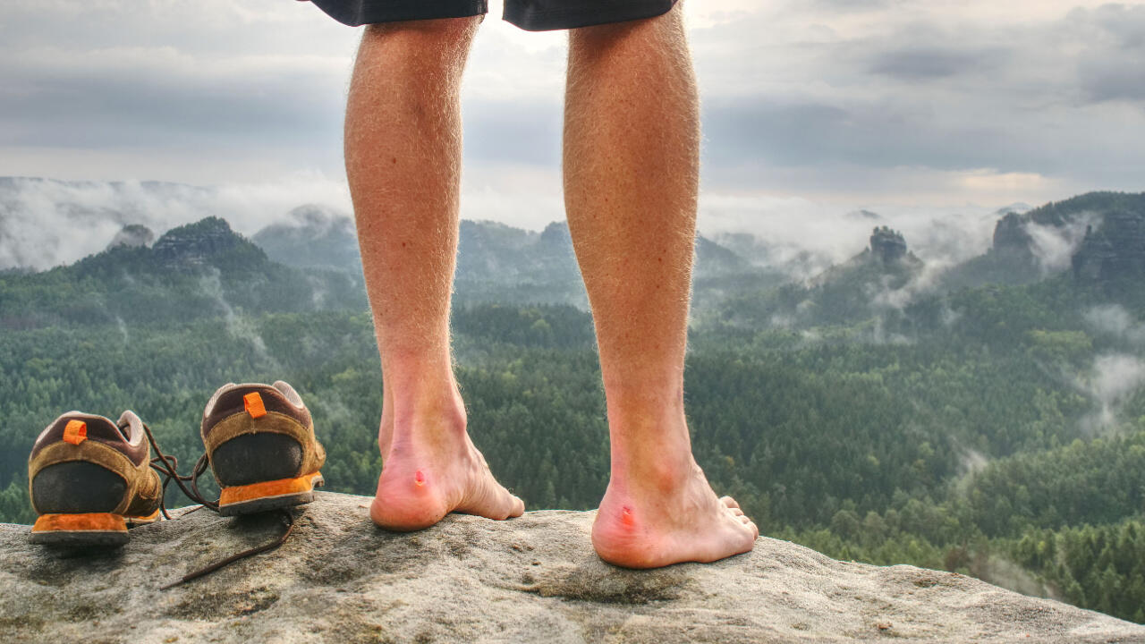 Eine Blase am Fuß entsteht oft, wenn Schuhe noch nicht gut eingetragen sind.