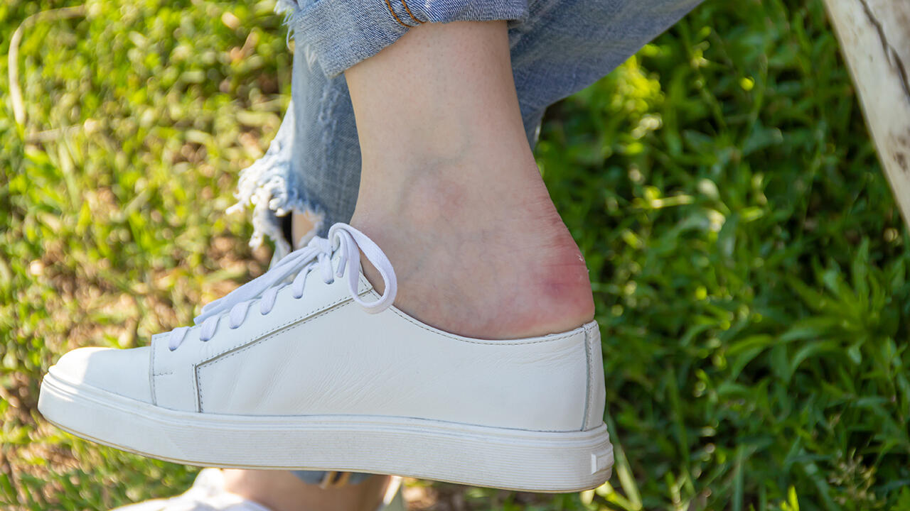 Besonders in neuen Schuhen entstehen schnell Blasen. Da sind Blasenpflaster praktische Helfer.