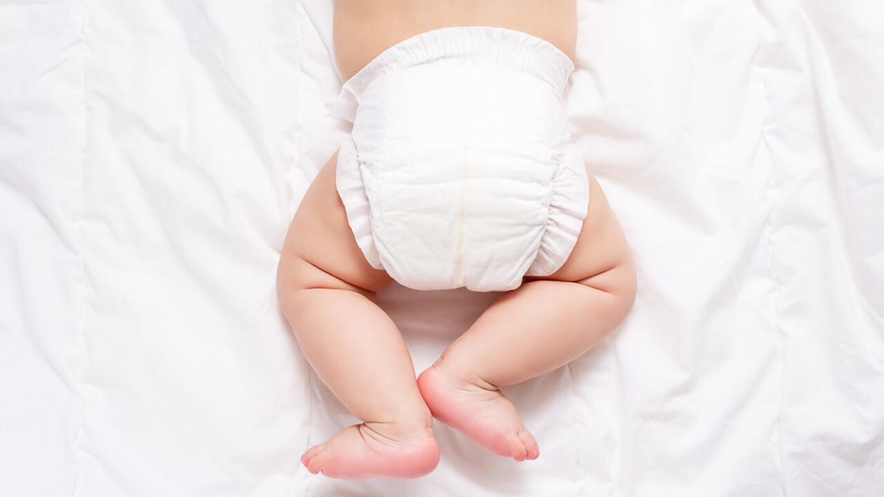 Das feucht-warme Klima in der Babywindel kann schnell zu Hautreizungen führen.