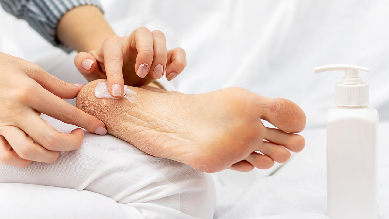 Fußcremes mit Urea sollen besonders trockene und rissige Haut wieder geschmeidig machen.