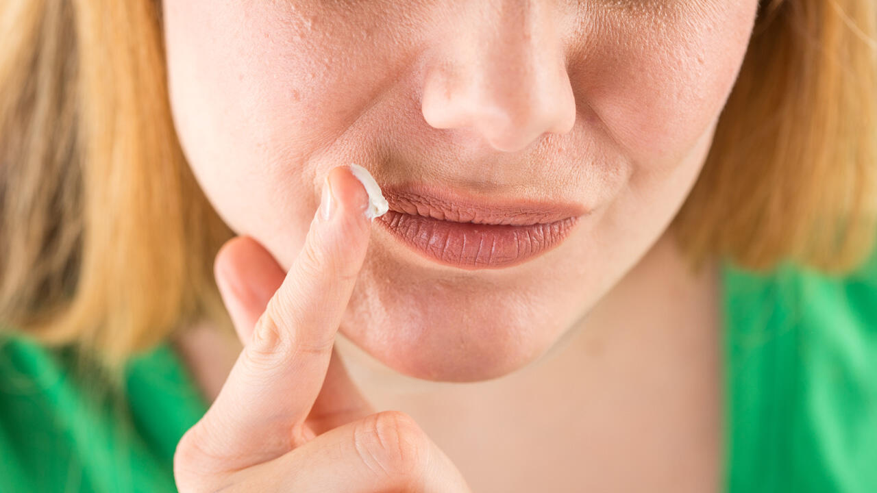 Gegen die trockene Haut und damit gegen Rhagaden: Gerade im Winter ist eine gute Haut- und Lippenpflege wichtig.