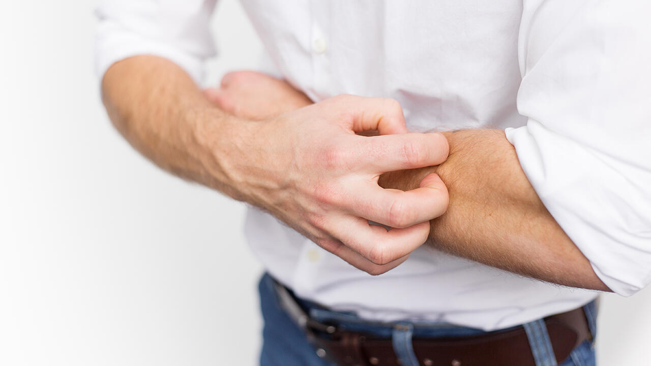 Neurodermitis: Pflegelotionen können helfen, den Juckreiz zu lindern. Neurodermitis: Pflegelotionen können helfen, den Juckreiz zu lindern.