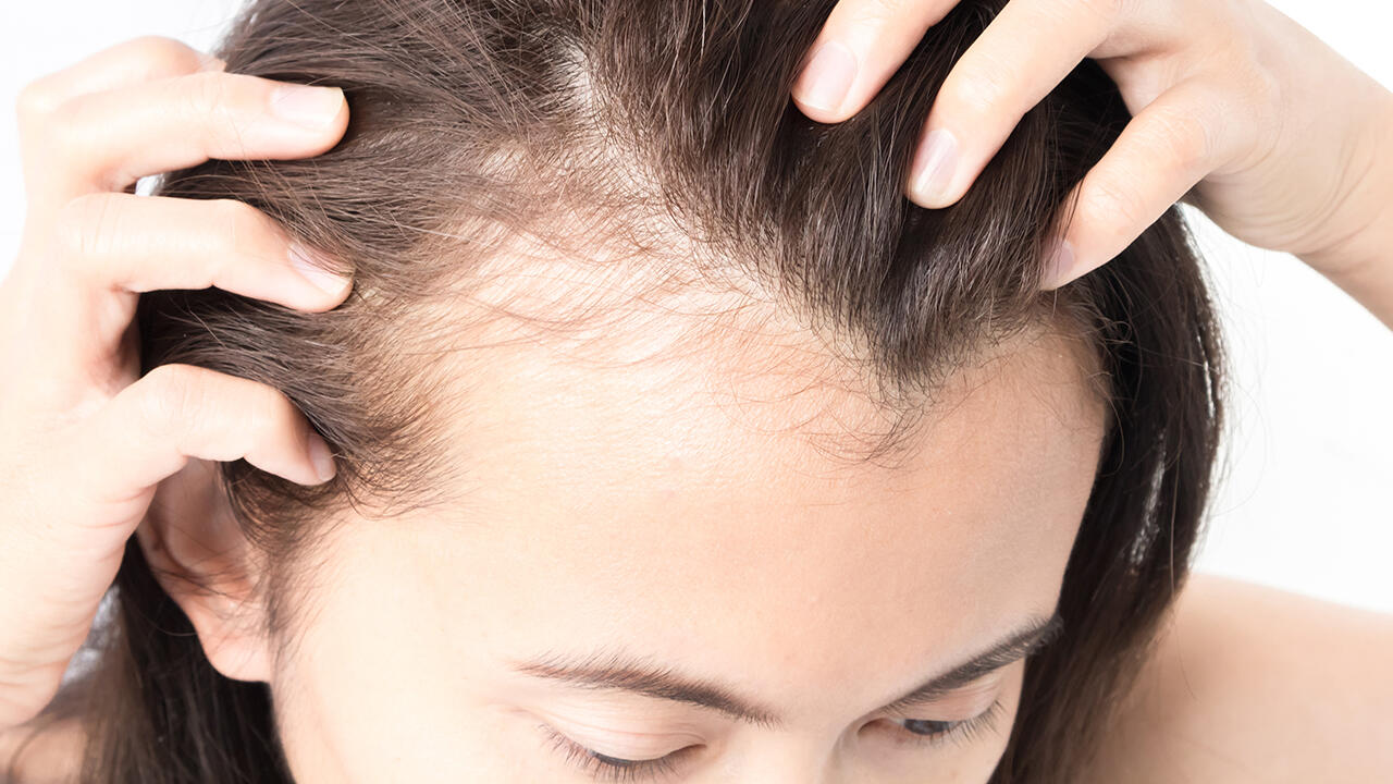 Shampoos gegen Haarausfall im Test: Viele fallen durch.