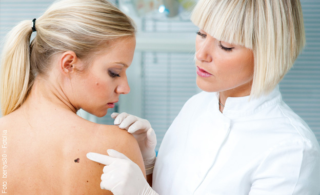 Nur der Hautarzt kann Hautkrebs zuverlässig erkennen - eine vorsorgliche Beobachtung der Haut ist trotzdem sinnvoll.