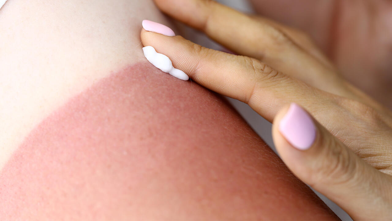 After-Sun-Lotion verspricht Pflege und Kühlung nach einem Tag am Strand. After-Sun-Lotion verspricht Pflege und Kühlung nach einem Tag am Strand.