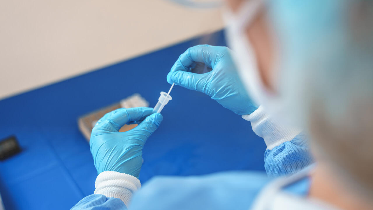 Antikörpertests, die im Labor ausgewertet werden, liefern zuverlässigere Ergebnisse als Schnelltests. Antikörpertests, die im Labor ausgewertet werden, liefern zuverlässigere Ergebnisse als Schnelltests.