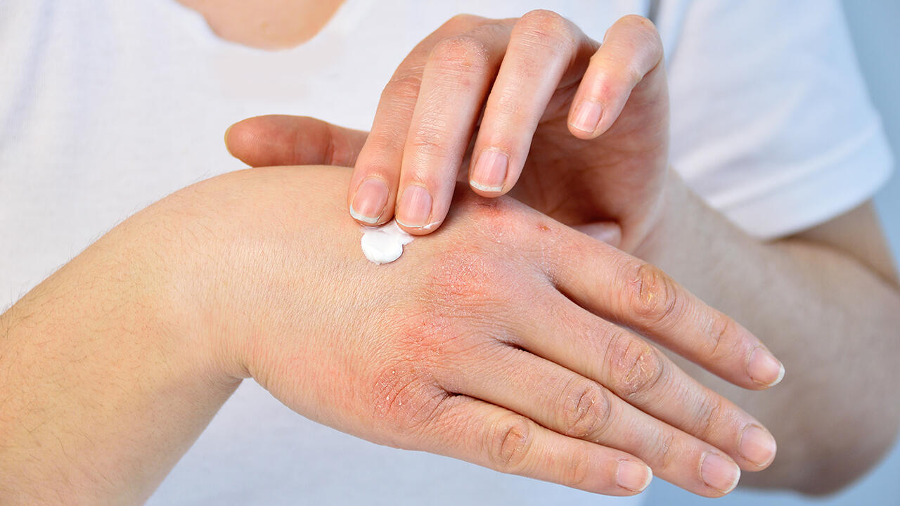 Die Handcreme O'Keeffe's Working Hands richtet sich an Menschen mit stark beanspruchter Haut. Umso ärgerlicher ist es, dass wir im Test Problemstoffe gefunden haben. Die Handcreme O'Keeffe's Working Hands richtet sich an Menschen mit stark beanspruchter Haut. Umso ärgerlicher ist es, dass wir im Test Problemstoffe gefunden haben.