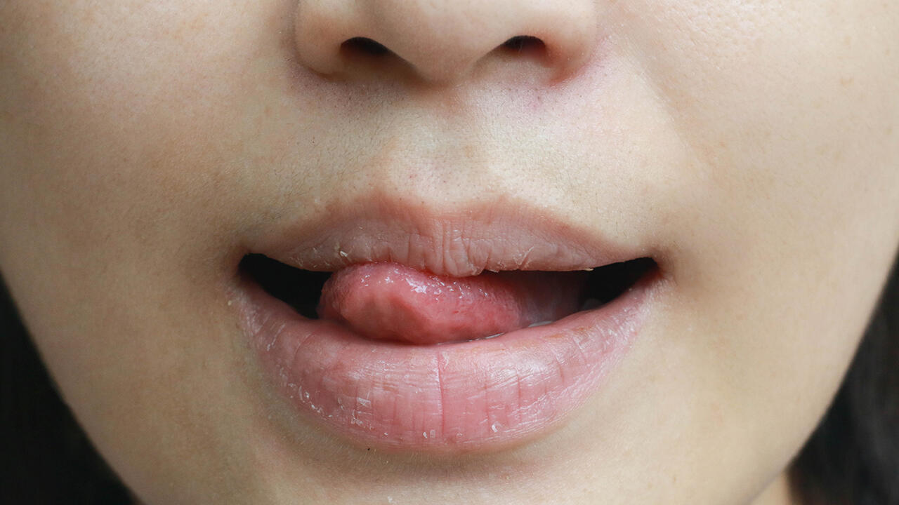 Die Lippen mit der Zunge zu befeuchten, ist kontraproduktiv: Davon trocknen die Lippen erst recht aus.