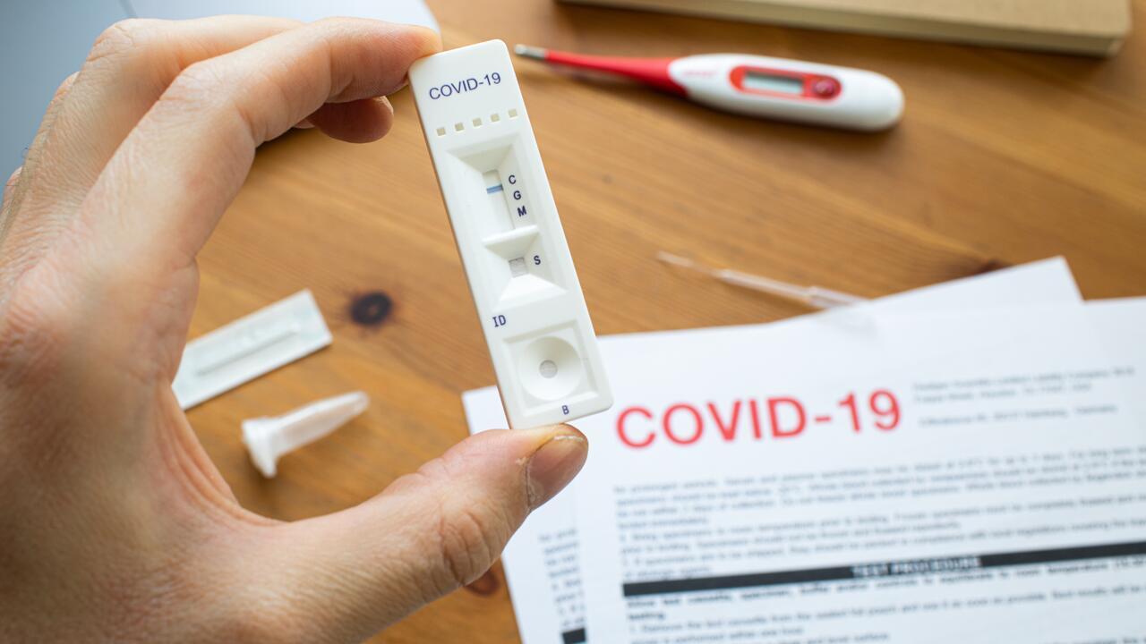 Schnelltests für Laien sind in der Anwendung ganz einfach. Schnelltests für Laien sind in der Anwendung ganz einfach.