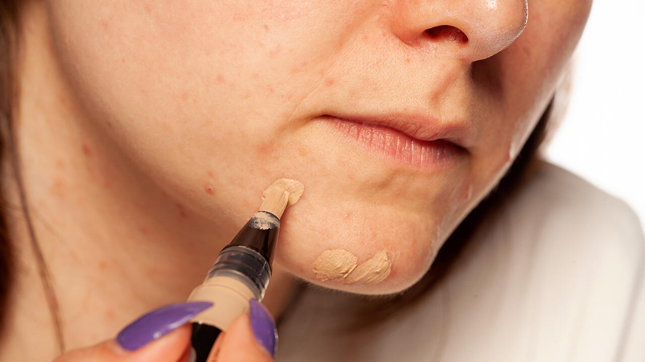 Schminken: Concealer deckt Rötungen und Pickelchen im Gesicht ab. Schminken: Concealer deckt Rötungen und Pickelchen im Gesicht ab.