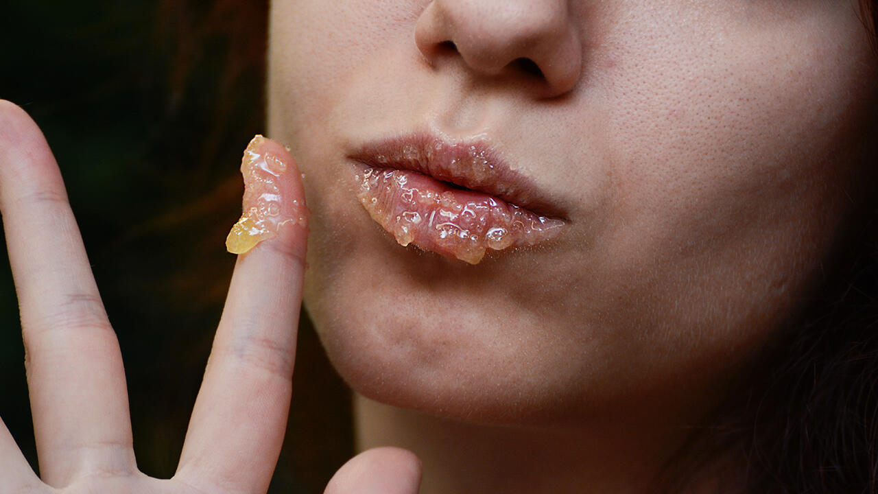 Wer spröde Lippen hat, kann sich einfach etwas Honig auf die Lippen schmieren.