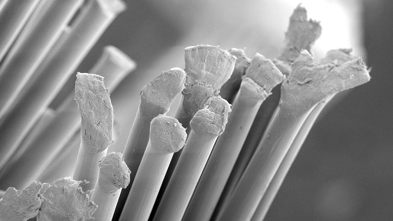 Ein unerwünschtes Bild: Borsten mit Ecken und Kanten statt Abrundungen. Experten untersuchten die Bürsten unter dem Rasterelektronenmikroskop. Ein unerwünschtes Bild: Borsten mit Ecken und Kanten statt Abrundungen. Experten untersuchten die Bürsten unter dem Rasterelektronenmikroskop.