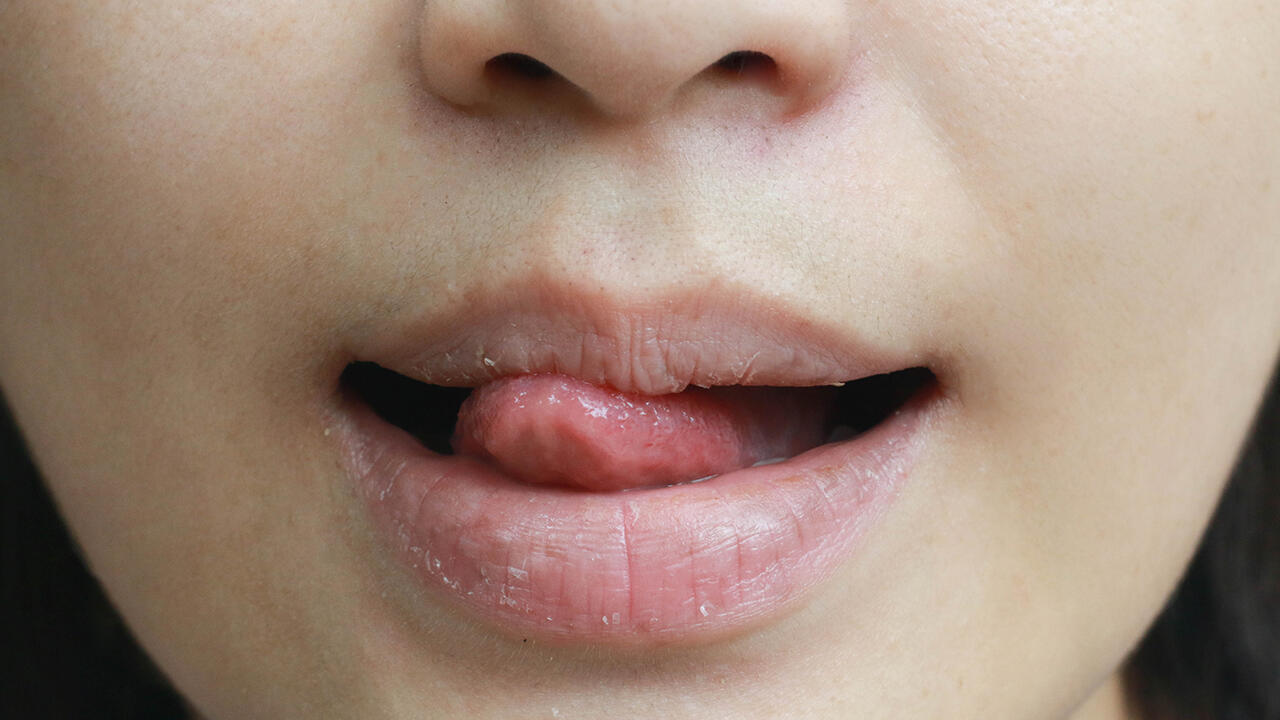 Es ist kontraproduktiv, die Lippen mit der Zunge zu befeuchten: Davon trocknen die Lippen erst recht aus. Es ist kontraproduktiv, die Lippen mit der Zunge zu befeuchten: Davon trocknen die Lippen erst recht aus.